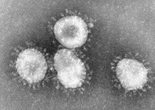 sars-coronavirus